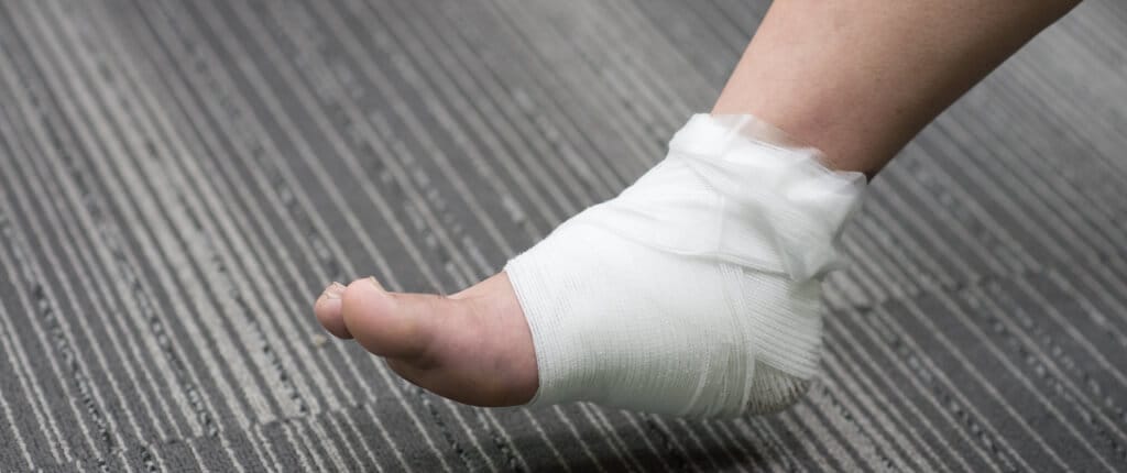 Bandaged Foot